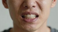 teeth grinding during stress